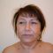 Blefaroplastie