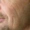 Kwas hialuronowy: Saypha, Restylane, Juvederm, Stylage