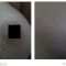 Stretch marks