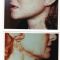 Lifting du visage