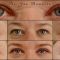 Operácia očných viečok (Blepharoplastika)