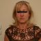 Exilis (Nicht-invasives Lifting)