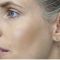 Mikrojehličkování, Microneedling (Skinroller - Dermaroller)