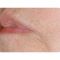 Radiofrekvenční rejuvenace - vyhlazení pleti (ShapeUp!, Aluma, Accent, TriPollar, Spa RF, Radiofrequency Re-Styling, Re-Age, Pellevé)