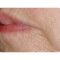 Radiofrekvenční rejuvenace - vyhlazení pleti (ShapeUp!, Aluma, Accent, TriPollar, Spa RF, Radiofrequency Re-Styling, Re-Age, Pellevé)