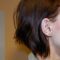 Rhinoplasty (Nose Job)
