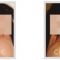 Plastika nosu (Rhinoplastika)