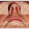 Plastika nosu (Rhinoplastika)