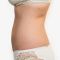 Liposuction