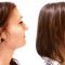 Rhinoplasty (Nose Job)
