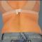 CoolSculpting