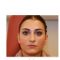 Rhinoplastie