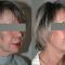 Lifting du visage