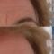 Filler