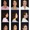 Facelift, SMAS facelifting