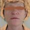 Facelift