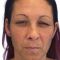Nichtchirurgische Faltenbehandlung - BOTOX® / DYSPORT®