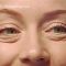 Hyaluronic acid-based wrinkle fillers