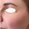 Dermal fillers