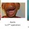 Chirurgie réparatrice du visage