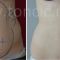 Liposuction