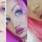 Lip Lift - powiększanie ust