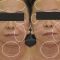 Antiaging