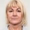 Kwas hialuronowy: Saypha, Restylane, Juvederm, Stylage
