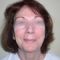 Facelift, SMAS facelifting