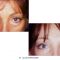 Blépharoplastie inférieure