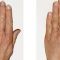 Skinbooster – Vital Injector