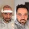 Haartransplantation