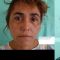 Lifting facial APTOS