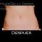 CoolSculpting