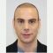 Facelift, SMAS Facelift