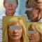 Facelift, SMAS facelifting