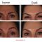 BOTOX® / DYSPORT®, Botulina - pentru îndepărtarea ridurilor.