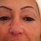 Lifting facial