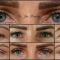 Operácia obočia (Brow lift)