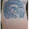 Rimozione tatuaggi - laser