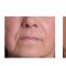 Filler antirughe a base di acido ialuronico