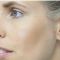 Mikrojehličkování, Microneedling (Skinroller - Dermaroller)