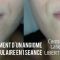 Traitements laser - dermatologie esthétique