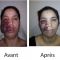 Chirurgie réparatrice du visage