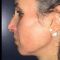Anti-Aging