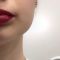 Lippenvergrößerung mit PermaLip