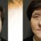 Facelift