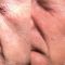 Anti aging