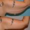 Lifting delle braccia