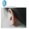 Otoplastie (Chirurgie esthétique des oreilles)